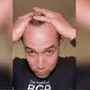 بخاخ لنمو الشعر